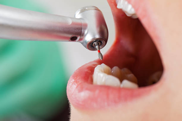 Best Walk-In Emergency Dentist in Coburg, OR